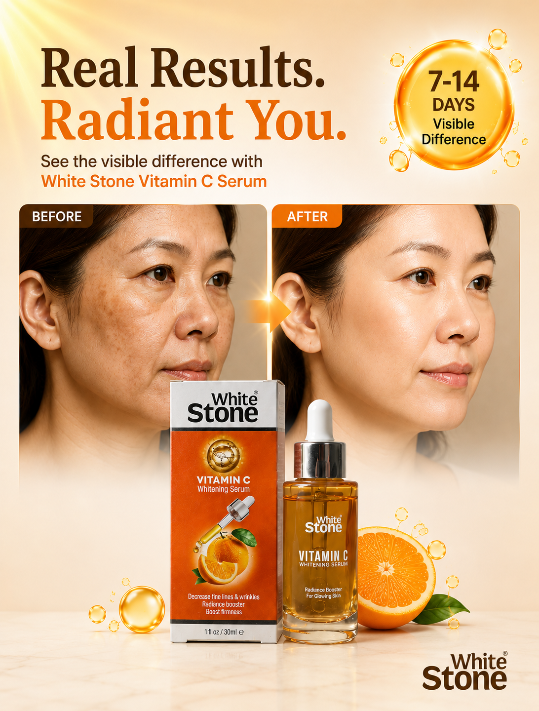 White Stone Vitamin C Brightening Serum – Tone Even & Spot Fader