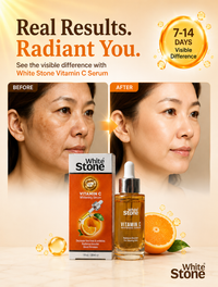 White Stone Vitamin C Brightening Serum – Tone Even & Spot Fader